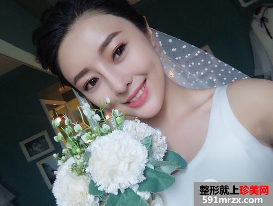 鼻综合613