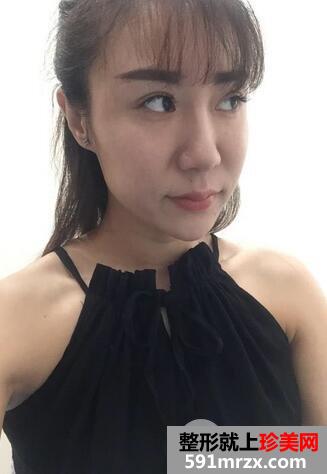 嫩肤去皱纹1