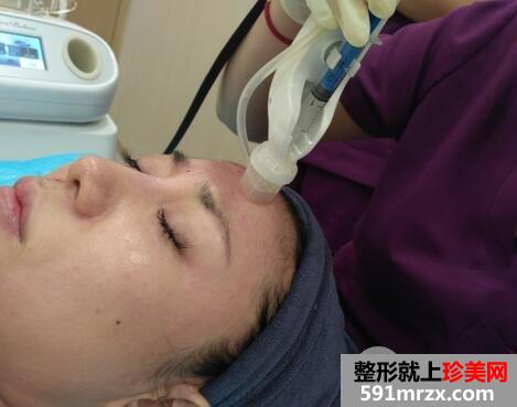 嫩肤去皱纹5