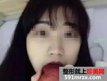 瘦脸针打几次定型