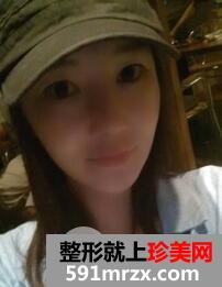 去鼻唇沟4