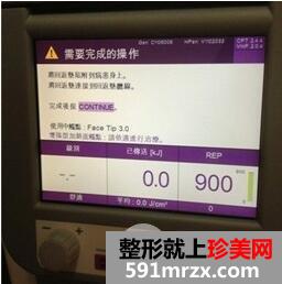 冰电波拉皮好吗5