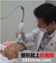 冰电波拉皮好吗6