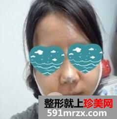 磨骨瘦脸10