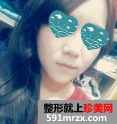 磨骨瘦脸13