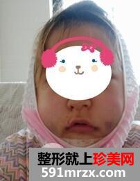 双鄂整形2