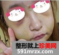 双鄂整形3