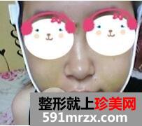 双鄂整形4