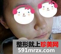 双鄂整形5