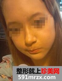 双鄂整形6
