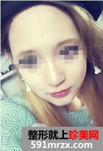 双鄂整形7