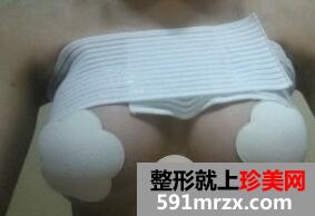 假体隆胸4
