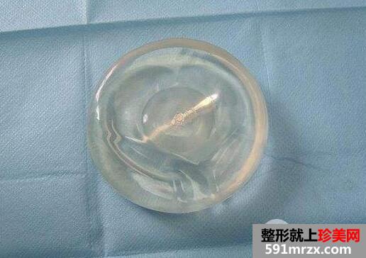 假体隆胸影响哺乳吗5