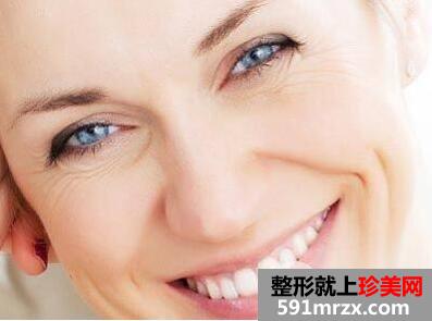 表情纹怎么去掉2