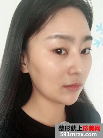 怎么变瓜子脸2
