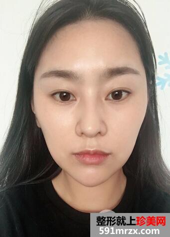 怎么变瓜子脸3