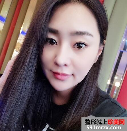 怎么变瓜子脸14