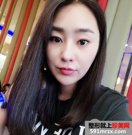 怎么变瓜子脸15