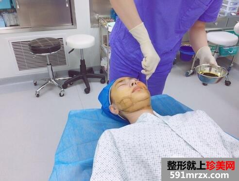怎么变瓜子脸4