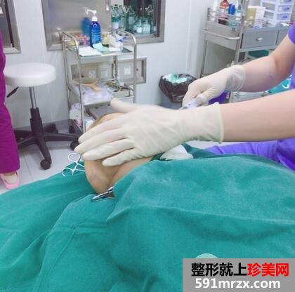 怎么变瓜子脸6