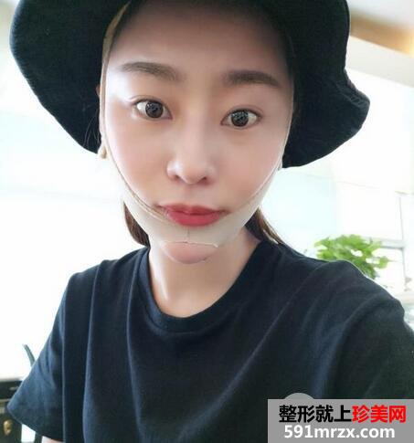 怎么变瓜子脸8