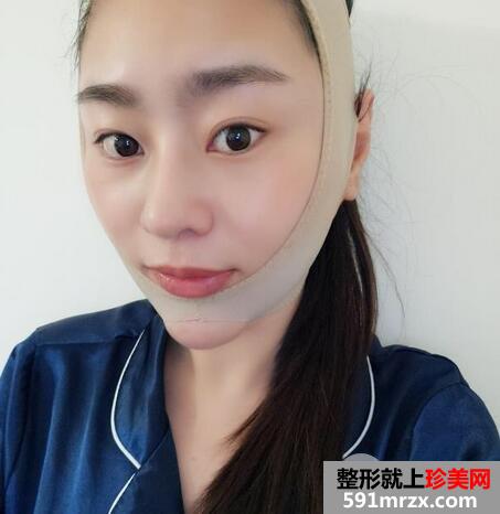怎么变瓜子脸9
