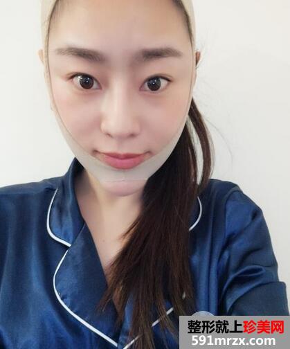 怎么变瓜子脸10