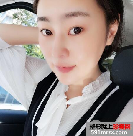 怎么变瓜子脸11