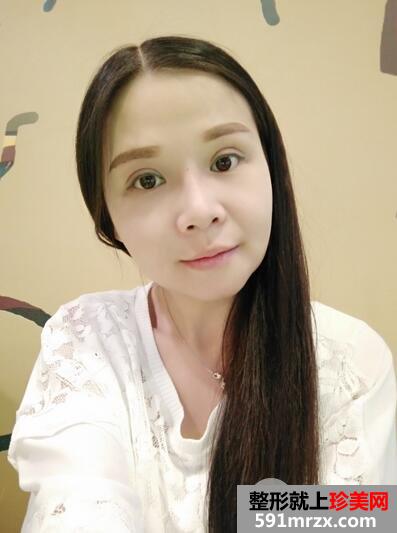 磨骨手术6