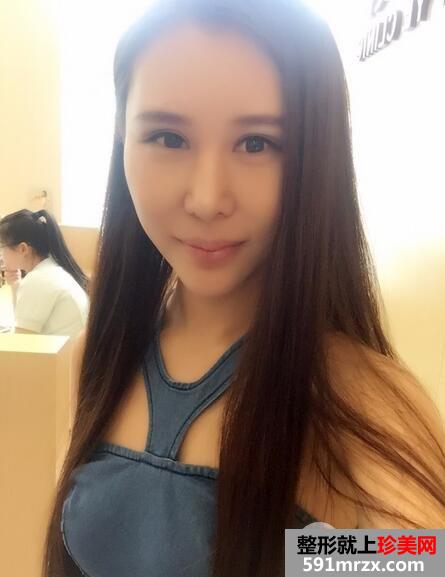 瘦脸针6