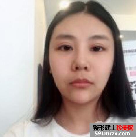 怎样变瓜子脸1