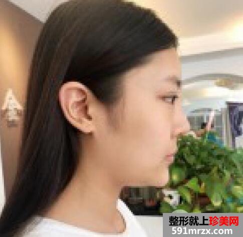 怎样变瓜子脸2
