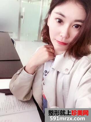 做双眼皮手术安全吗7