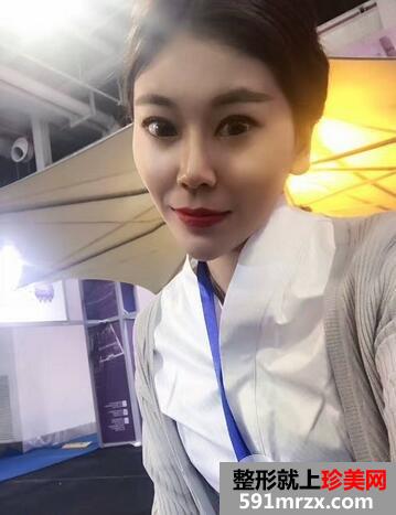 做双眼皮手术安全吗10