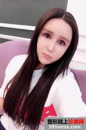 吸脂瘦脸9