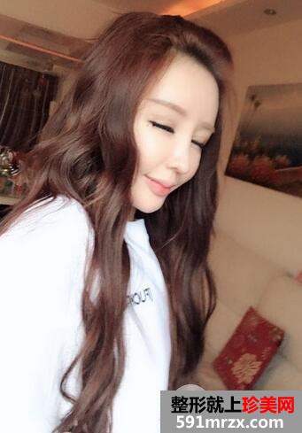 吸脂瘦脸13