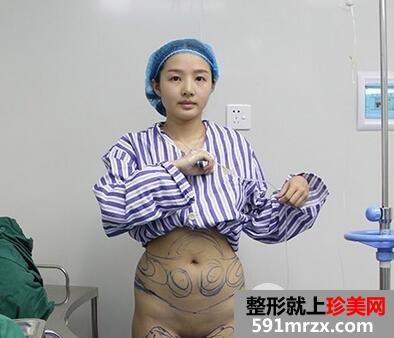360溶脂减肥4