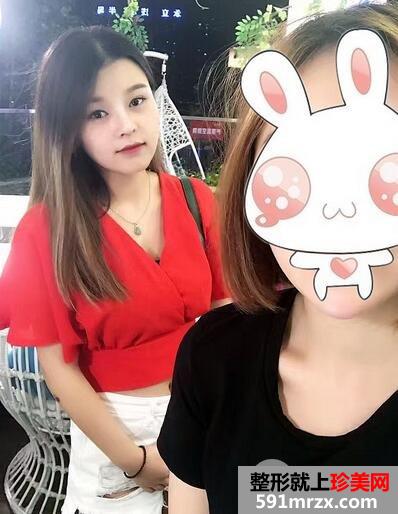 怎样使鼻子变挺6