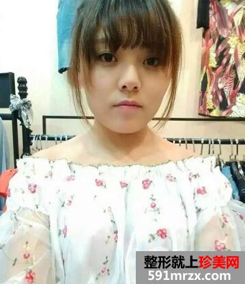 垫高鼻子1