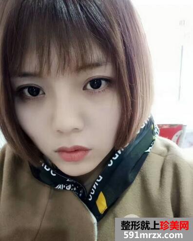 垫高鼻子10