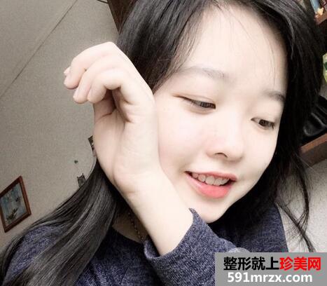 如何快速美白手臂3