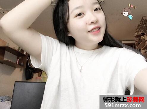 如何快速美白手臂4