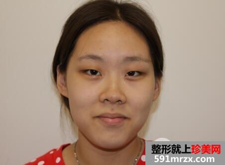 北京叶美人2