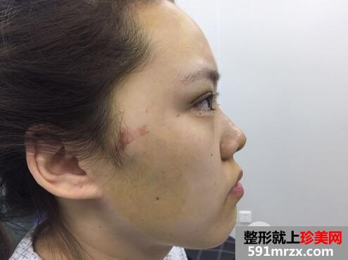 北京叶美人5