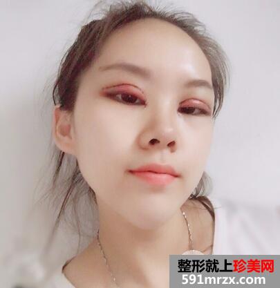 北京叶美人7