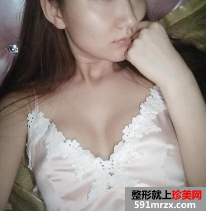 假体隆胸6