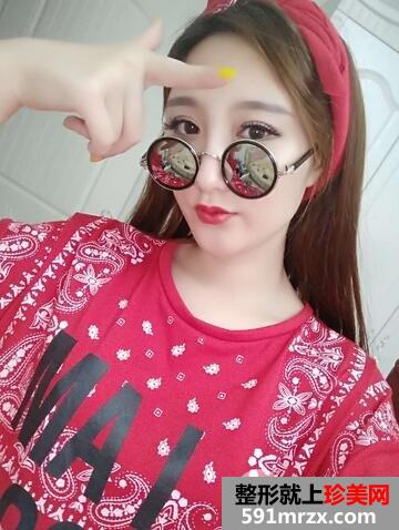 假体隆胸9