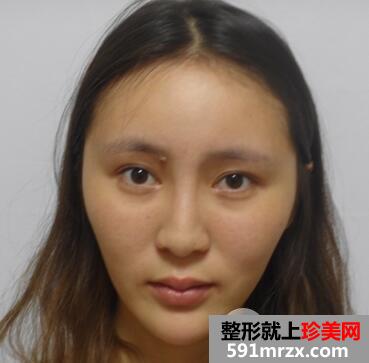 鼻综合1