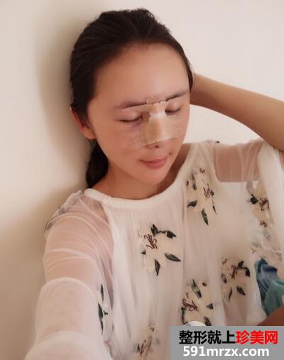 鼻综合5