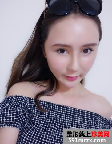 鼻综合7